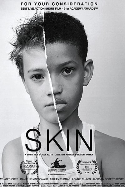 Skin